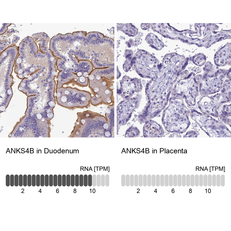 Atlas Antibodies Anti-ANKS4B Antibody