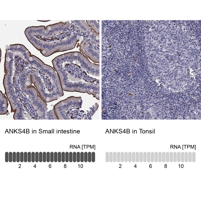 Atlas Antibodies Anti-ANKS4B Antibody