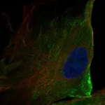 Atlas Antibodies Anti-ANO10 Antibody
