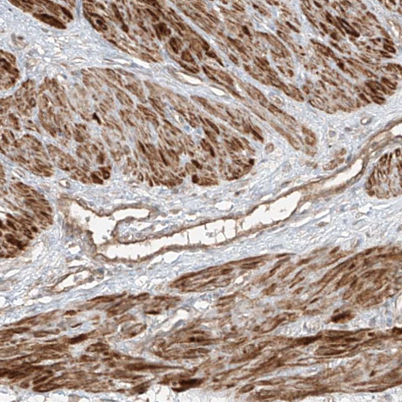 Atlas Antibodies Anti-ANKZF1 Antibody