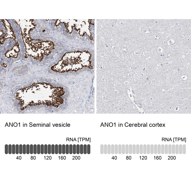 Atlas Antibodies Anti-ANO1 Antibody