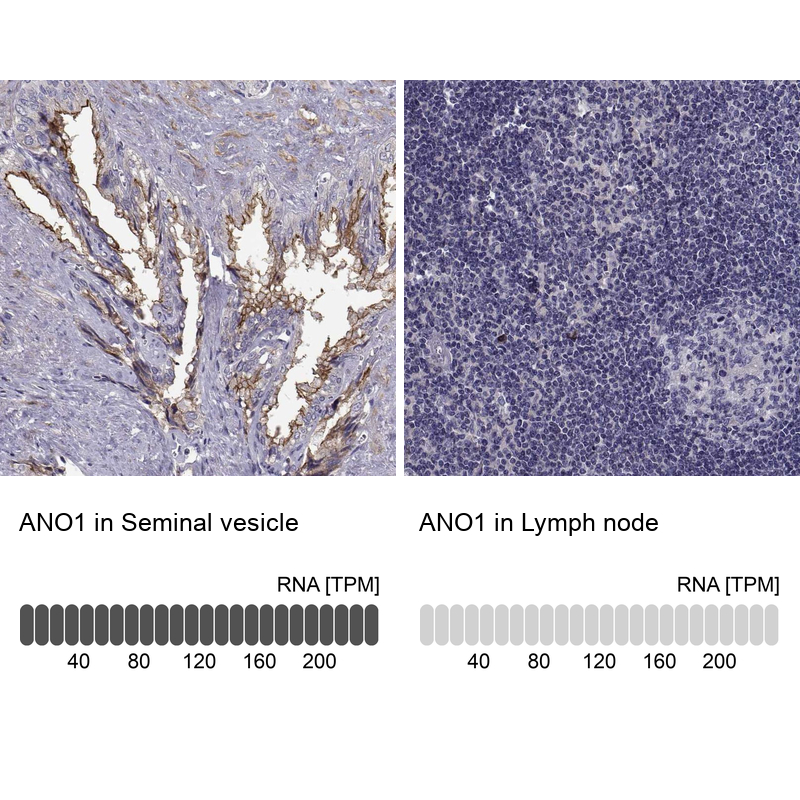 Atlas Antibodies Anti-ANO1 Antibody