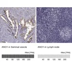 Atlas Antibodies Anti-ANO1 Antibody