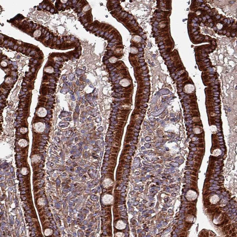 Atlas Antibodies Anti-ANO10 Antibody
