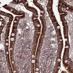 Atlas Antibodies Anti-ANO10 Antibody