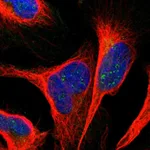 Atlas Antibodies Anti-ANKS6 Antibody