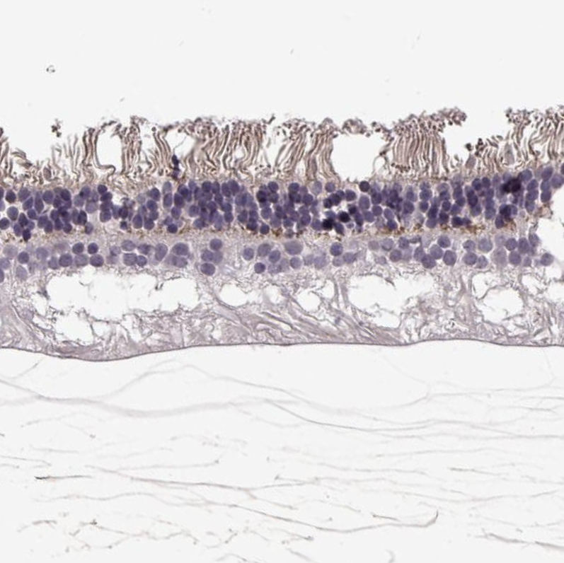 Atlas Antibodies Anti-ANO2 Antibody