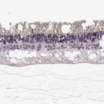 Atlas Antibodies Anti-ANO2 Antibody