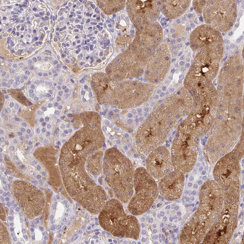 Atlas Antibodies Anti-ANO5 Antibody