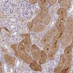 Atlas Antibodies Anti-ANO5 Antibody