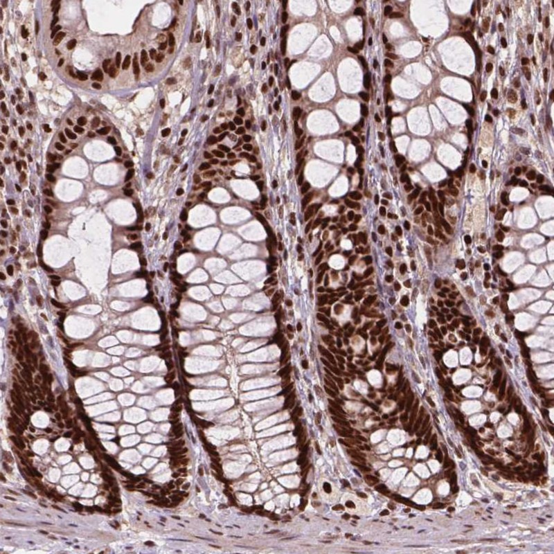 Atlas Antibodies Anti-ANP32A Antibody