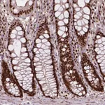 Atlas Antibodies Anti-ANP32A Antibody