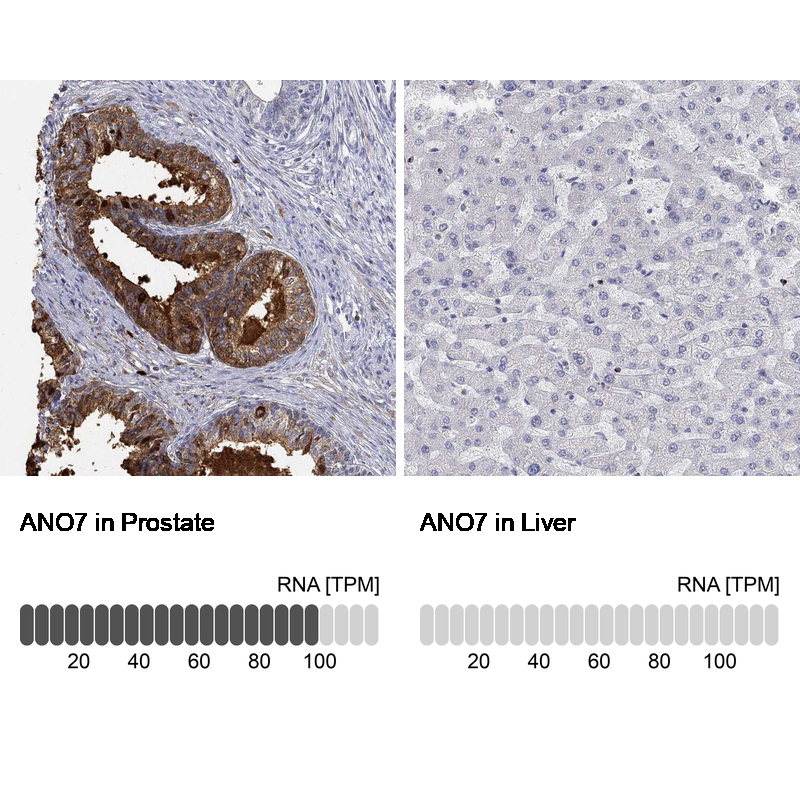 Atlas Antibodies Anti-ANO7 Antibody