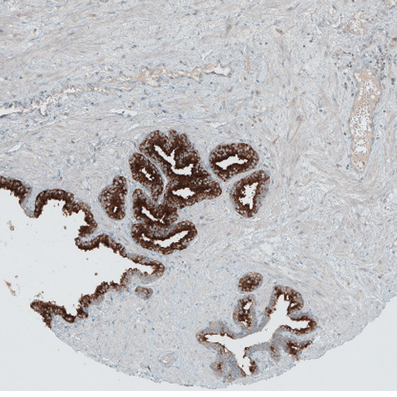 Atlas Antibodies Anti-ANO7 Antibody