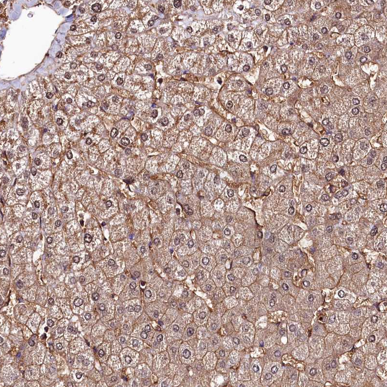 Atlas Antibodies Anti-ANO6 Antibody