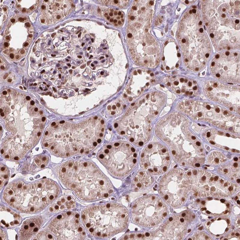 Atlas Antibodies Anti-ANP32A Antibody