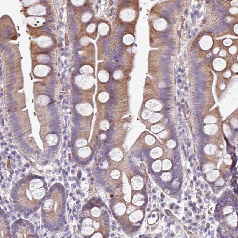 Atlas Antibodies Anti-ANO9 Antibody