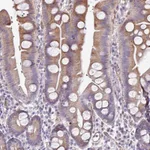 Atlas Antibodies Anti-ANO9 Antibody
