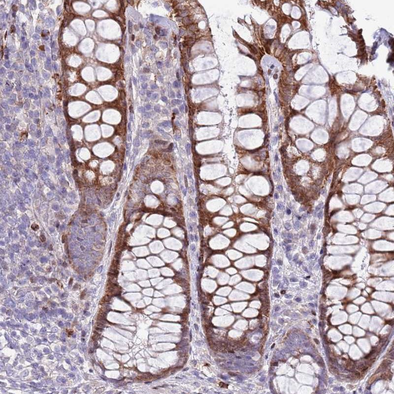 Atlas Antibodies Anti-ANO8 Antibody