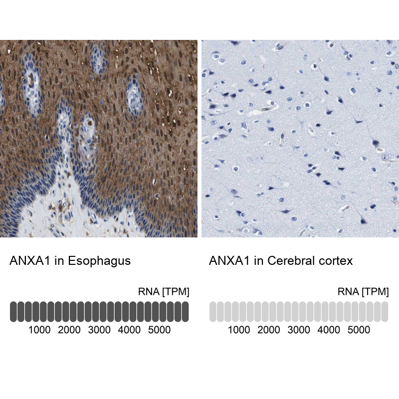Atlas Antibodies Anti-ANXA1 Antibody