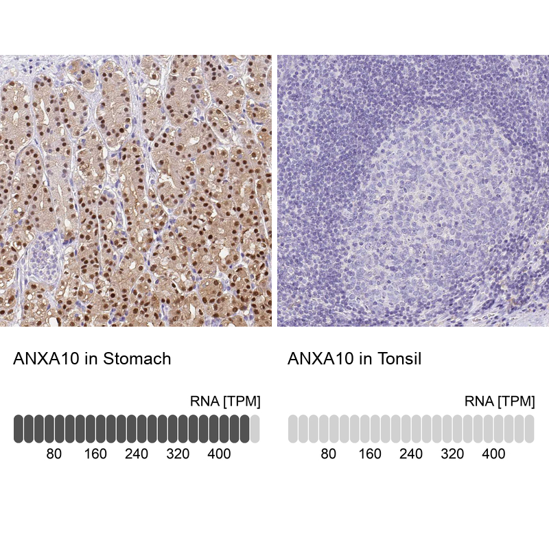 Atlas Antibodies Anti-ANXA10 Antibody