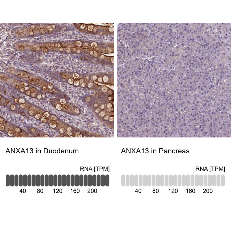 Atlas Antibodies Anti-ANXA13 Antibody