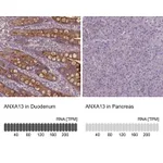 Atlas Antibodies Anti-ANXA13 Antibody