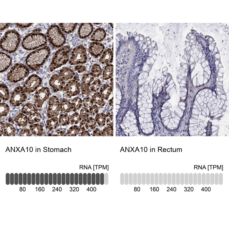 Atlas Antibodies Anti-ANXA10 Antibody