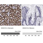 Atlas Antibodies Anti-ANXA10 Antibody