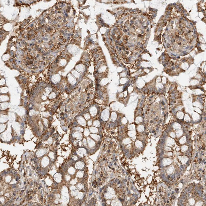 Atlas Antibodies Anti-ANXA11 Antibody