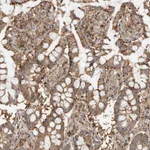 Atlas Antibodies Anti-ANXA11 Antibody