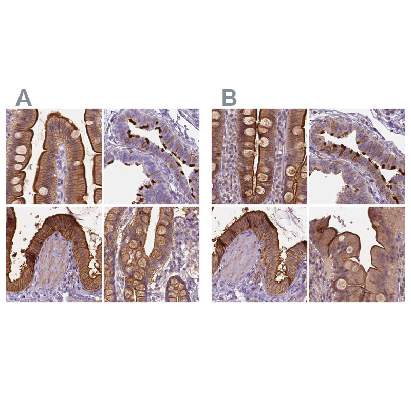 Atlas Antibodies Anti-ANXA13 Antibody