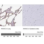 Atlas Antibodies Anti-ANXA2 Antibody