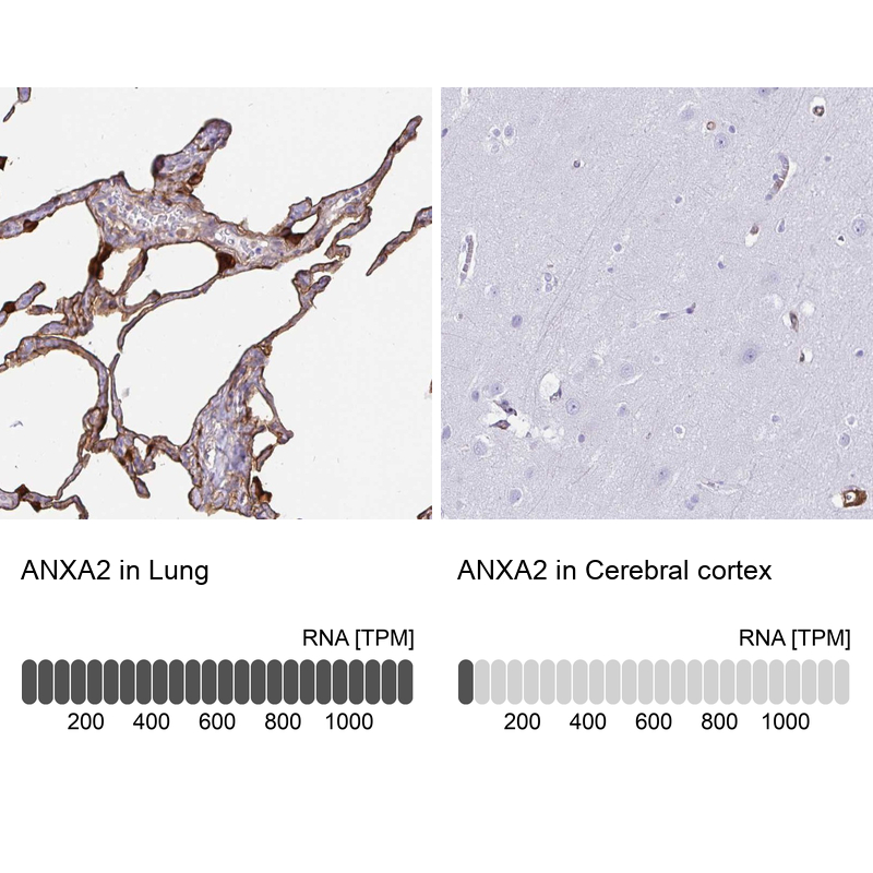 Atlas Antibodies Anti-ANXA2 Antibody