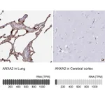 Atlas Antibodies Anti-ANXA2 Antibody