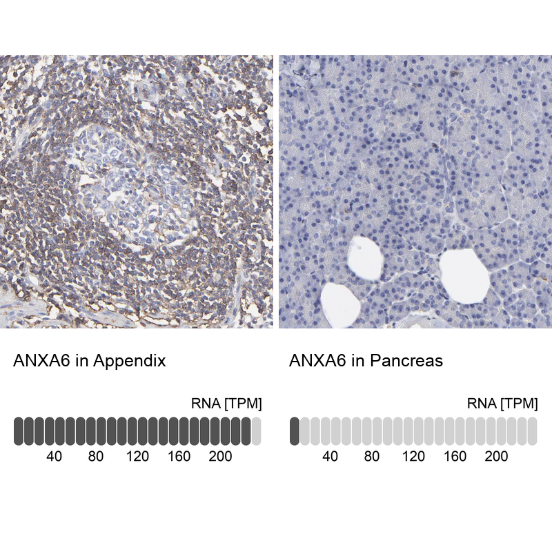 Atlas Antibodies Anti-ANXA6 Antibody