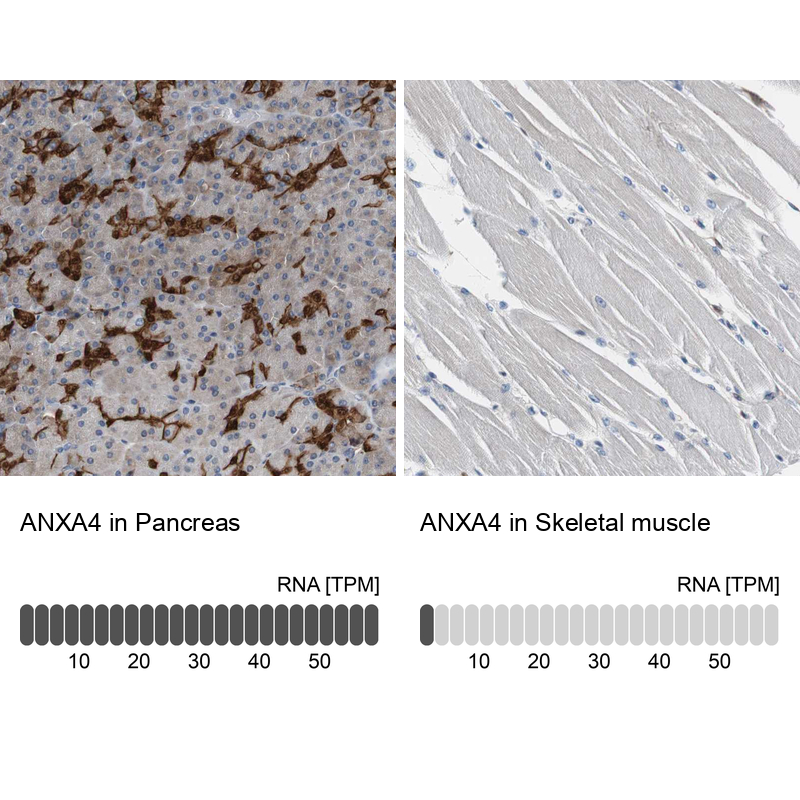 Atlas Antibodies Anti-ANXA4 Antibody