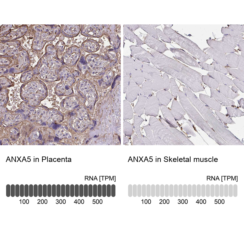 Atlas Antibodies Anti-ANXA5 Antibody