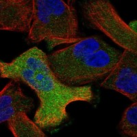 Atlas Antibodies Anti-ANXA6 Antibody