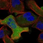 Atlas Antibodies Anti-ANXA6 Antibody