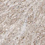 Atlas Antibodies Anti-ANXA6 Antibody