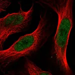 Atlas Antibodies Anti-ANXA8 Antibody