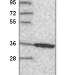 Atlas Antibodies Anti-ANXA8 Antibody