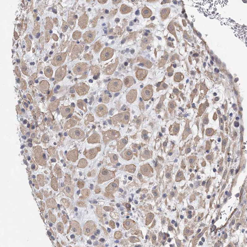Atlas Antibodies Anti-AOC1 Antibody