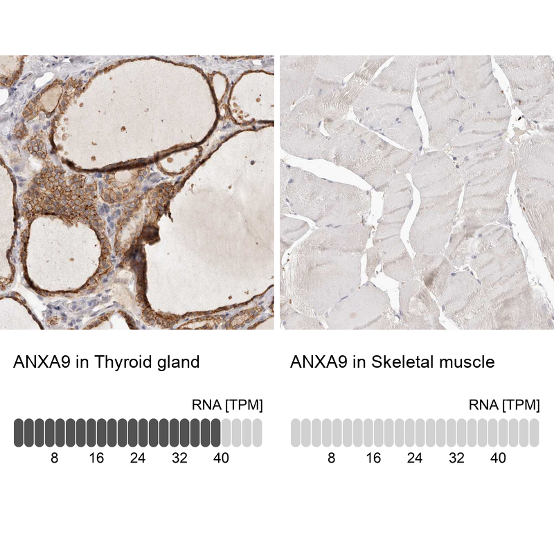 Atlas Antibodies Anti-ANXA9 Antibody
