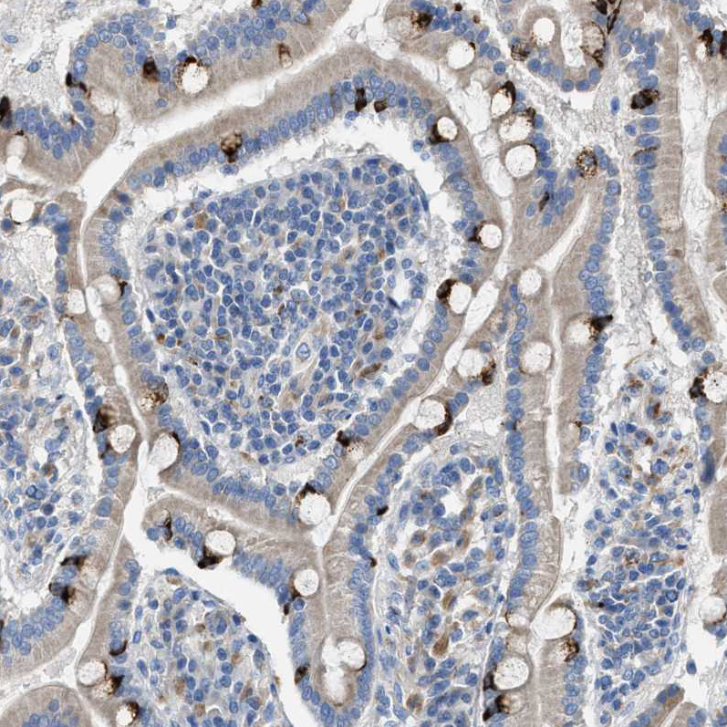 Atlas Antibodies Anti-AOAH Antibody