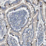 Atlas Antibodies Anti-AOAH Antibody