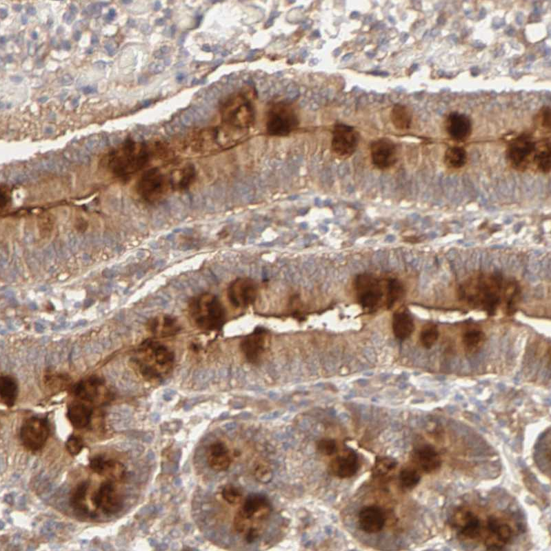Atlas Antibodies Anti-AP1G2 Antibody