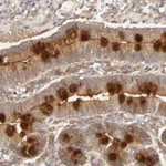 Atlas Antibodies Anti-AP1G2 Antibody