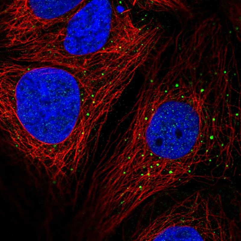 Atlas Antibodies Anti-AP1M2 Antibody